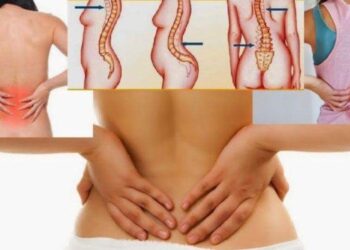 किन दुख्छ  कम्मर ? कसरी दुखाई कम गर्ने