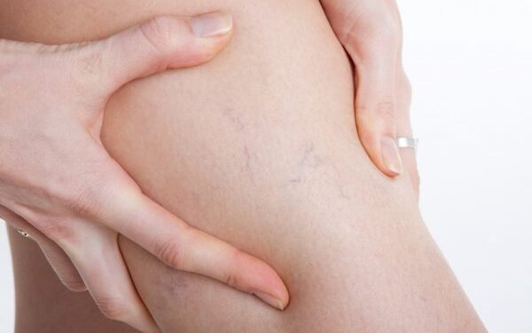 किन हातगोडा बाउँडिने गर्छन् ?