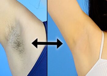 कुहिना , घाँटी , घुँडा र काखी कालो भएर चिन्तित हुनुहुन्छ भने अब यसो गर्नुहोस् !