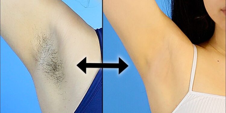 कुहिना , घाँटी , घुँडा र काखी कालो भएर चिन्तित हुनुहुन्छ भने अब यसो गर्नुहोस् !