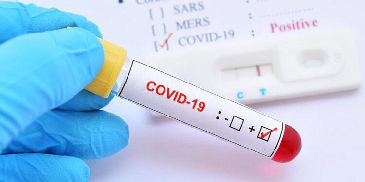 जापानमा संक्रमितको संख्या उच्च, एकैदिन करिब २४ हजार