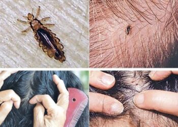 जुम्रा किन पर्छ ? यस्ता छन् कारण