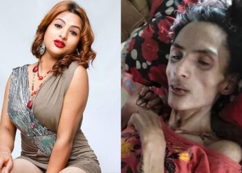 मोडल निशाको स्वास्थ्यमा देखिएन सुधार, उपचारमा ५० लाख बढी खर्च
