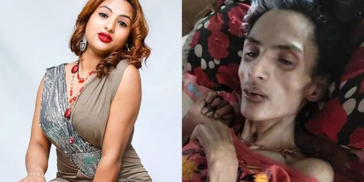 मोडल निशाको स्वास्थ्यमा देखिएन सुधार, उपचारमा ५० लाख बढी खर्च