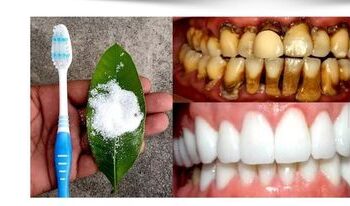 दाँत पहेलो हुने समस्या: अब दुई मिनेटमै घरेलु उपाय बाटै चम्किलो बनाउनुहोस् ……