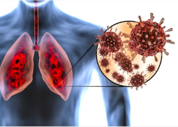 यस्तो लक्षण देखिनासाथ सत’र्क हुनुहोला, नत्र ज्या`नै जान सक्छ !
