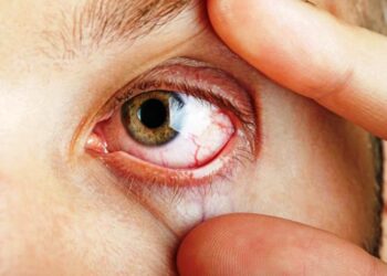 मधुमेहका कारण गुम्न सक्छ आँखाको ज्योती