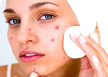 डन्डीफोर आउने समस्या कुन अवस्थामा बन्छ जटिल ?