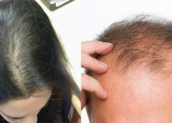 कपाल नुहाउने बित्तिकै गर्न नहुने यी ४ गल्तीहरु