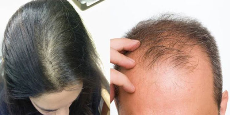 कपाल नुहाउने बित्तिकै गर्न नहुने यी ४ गल्तीहरु