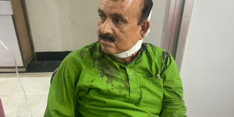 नेपाली काँग्रेसका सहमहामन्त्री महेन्द्र यादवमाथि खुकुरी प्रहार